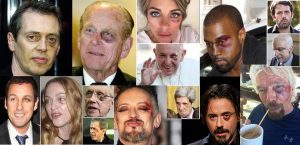 Just What Exactly Is 'The Black Eye Club,' And Why Are So Many Celebrities A Part Of It?